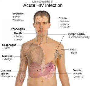 Aids Full form & Symptoms