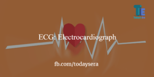 Full Form of ECG And Its Working